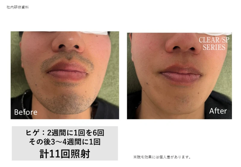 意外とみられている!!