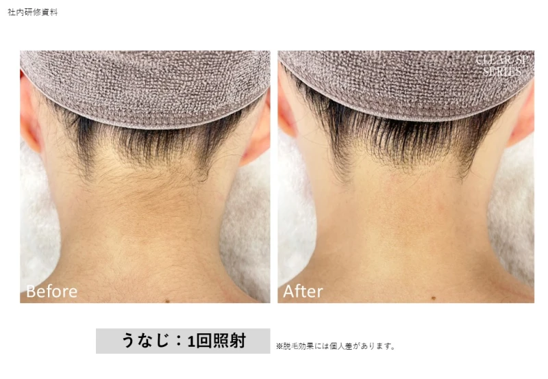 冬の今のうちから!!!